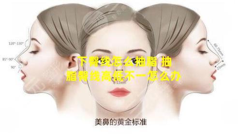 下臀线怎么抽脂 抽脂臀线高低不一怎么办